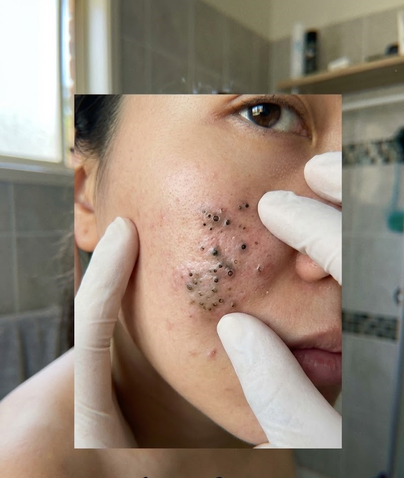 Killing Your Daughter